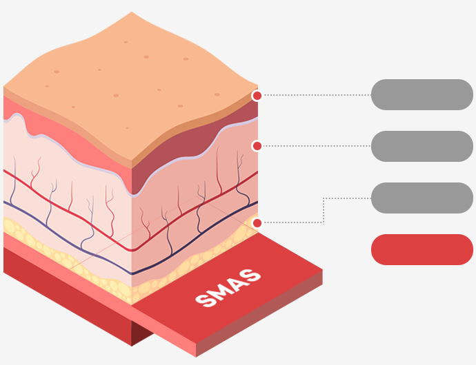 표피층·진피층·피하지방층·SMAS층을 보여주는 피부 단면 일러스트