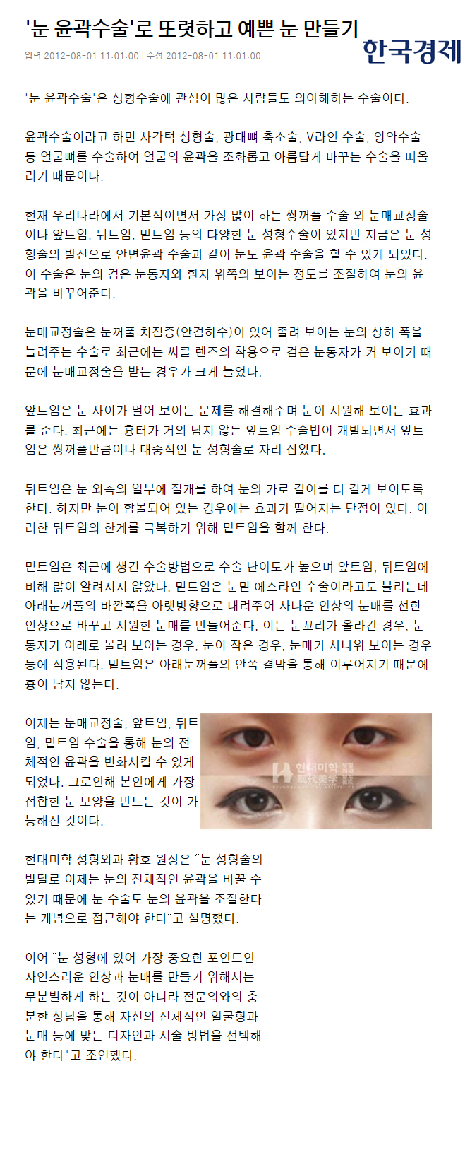 한국경제 보도 - '눈 윤곽수술'로 또렷하고 예쁜 눈 만들기