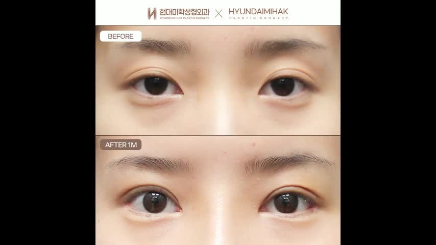 동영상