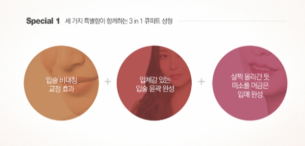 입술성형잘하는곳 세련된 웃는상 만들기