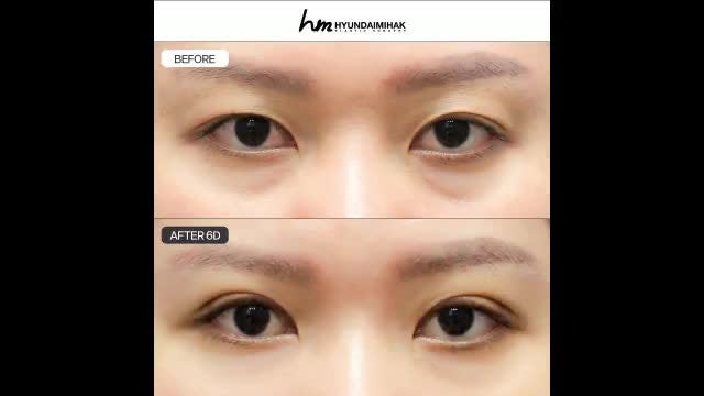동영상