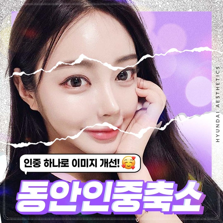 인중축소흉터 걱정은 연하게 인상은 또렷하게
