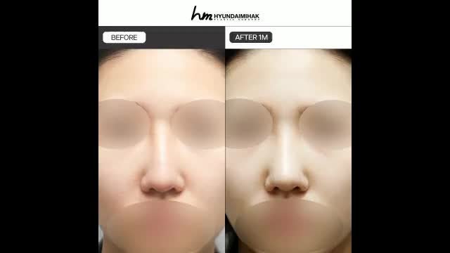 동영상