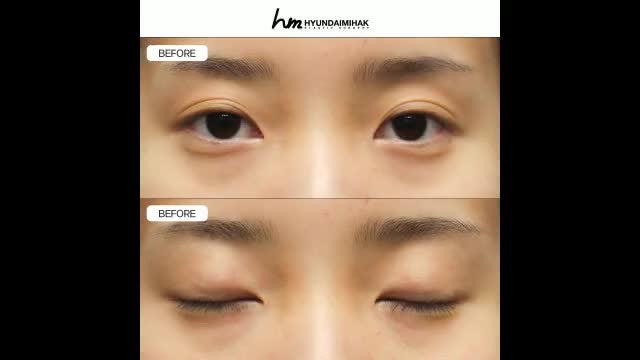 동영상