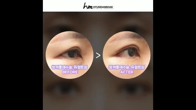 동영상
