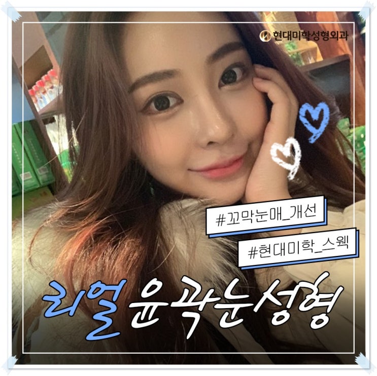 밑트임후기 결과가 궁금하다면?