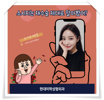 소시지눈재수술 눈 성형 더 신중하게 생각하자