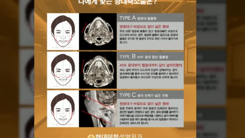 동영상