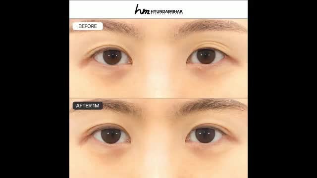 동영상