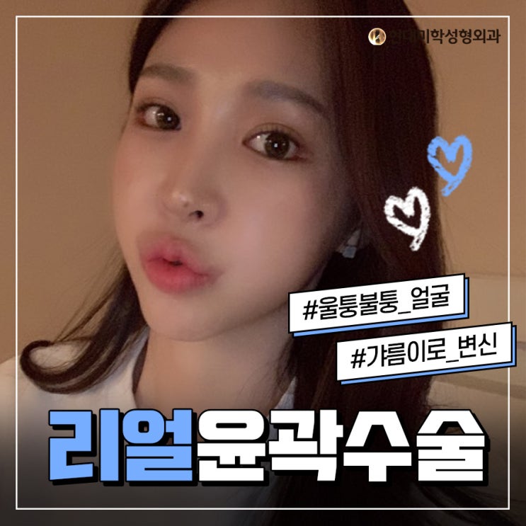 무턱전진술 컴플렉스 한방에