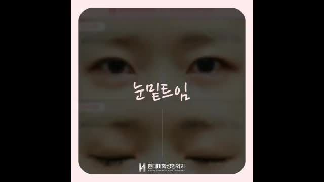 동영상