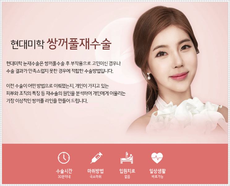 쌍수재수술 좀 더 예쁘게