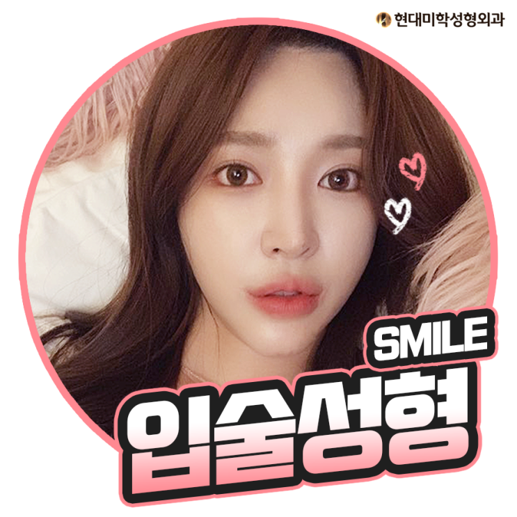 입매교정 밝은 기운이 살아나요