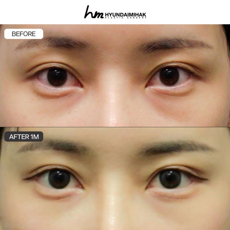 듀얼트임가격 낭비 없이 성공하는 조건
