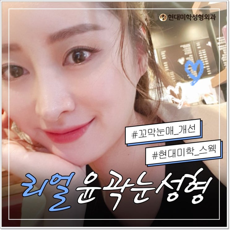 쌍커풀재수술잘하는곳 어디라구?