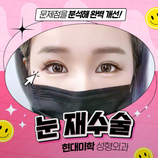 쌍꺼풀재수술잘하는병원 선택에 후회없이