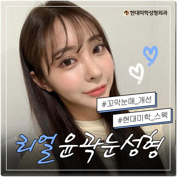 눈꼬리내리기수술 사납지 않아요