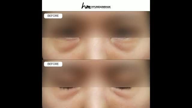 동영상