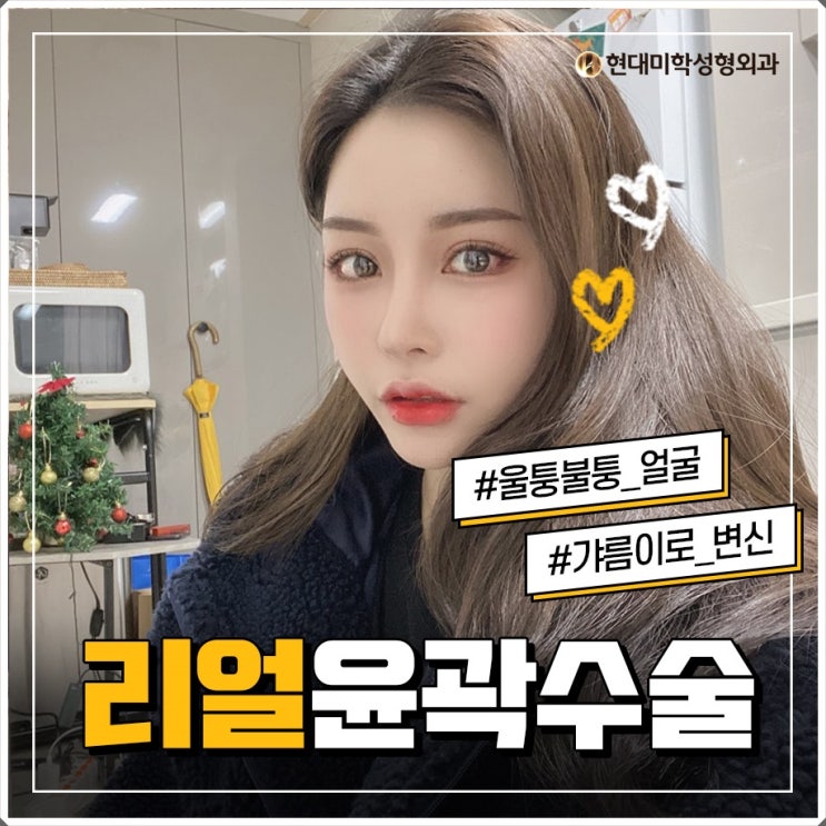 안면축소 직접 만나보세요