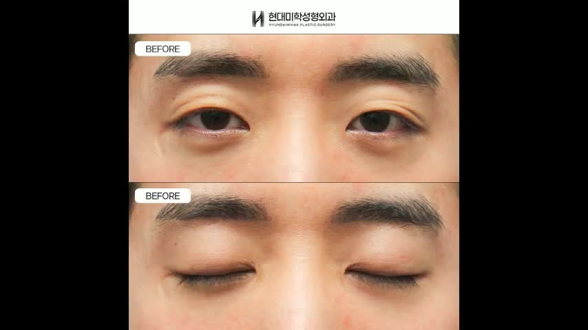동영상