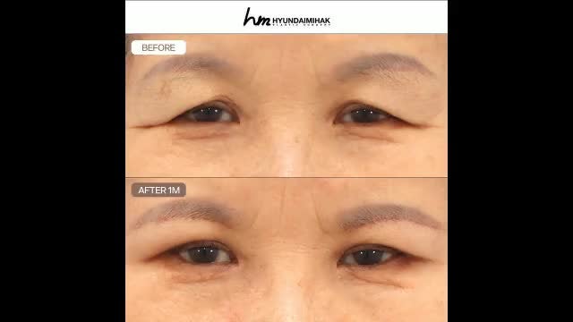 동영상