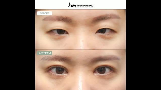 동영상