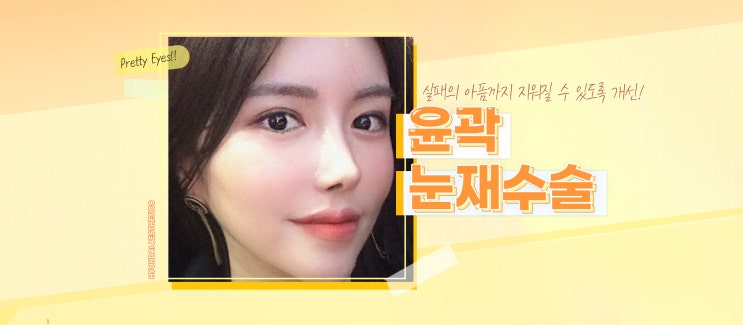 쌍꺼풀재수술잘하는병원 이렇게 알아봤어요.