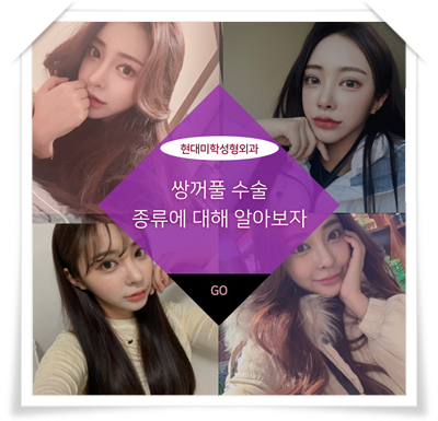 쌍꺼풀잘하는곳 선택을 잘해야 하는 이유