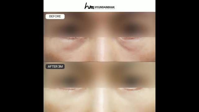 동영상