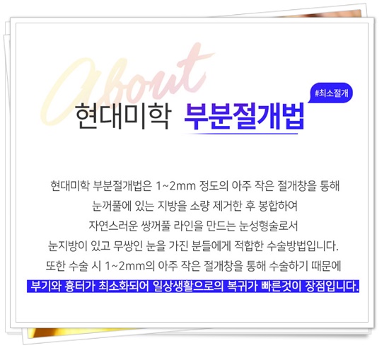 쌍수부분절개 과정과 효과 맛집 어디일까
