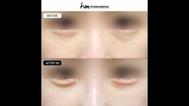 동영상