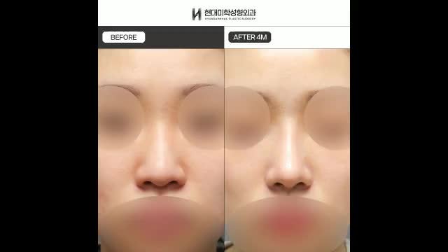 동영상