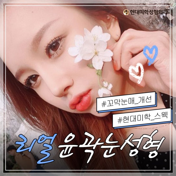 지방재배치비용 눈 밑을 화사하게