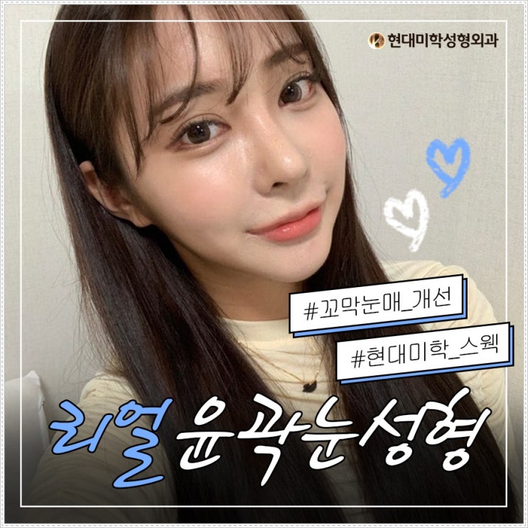 안검하수수술방법 이렇게이렇게