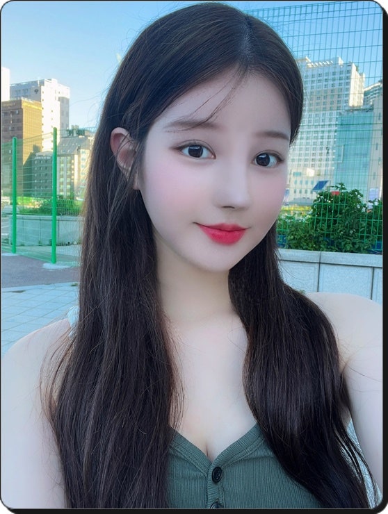 인중축소수술 흉터 걱정된다면 이걸 보세요