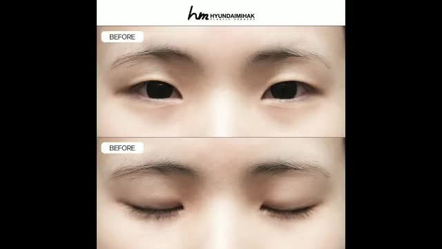 동영상
