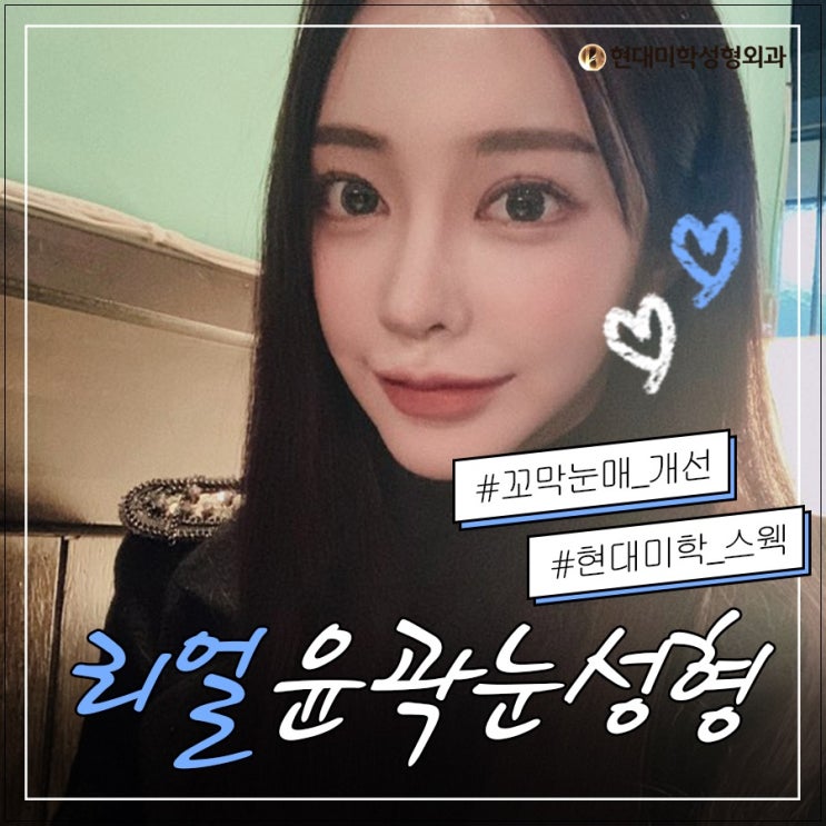 눈아래꺼짐 해결방법은?