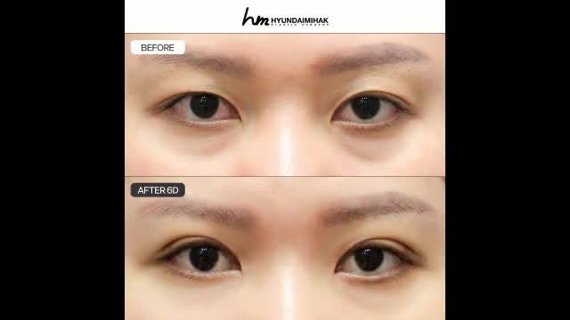 동영상