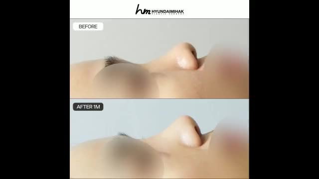 동영상