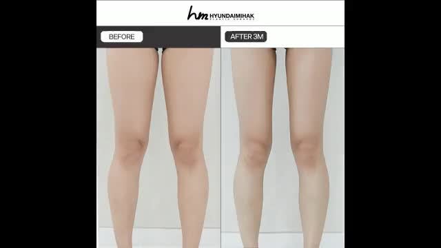 동영상
