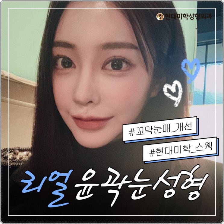 눈밑지방재배치전후 동안되기 프로젝트