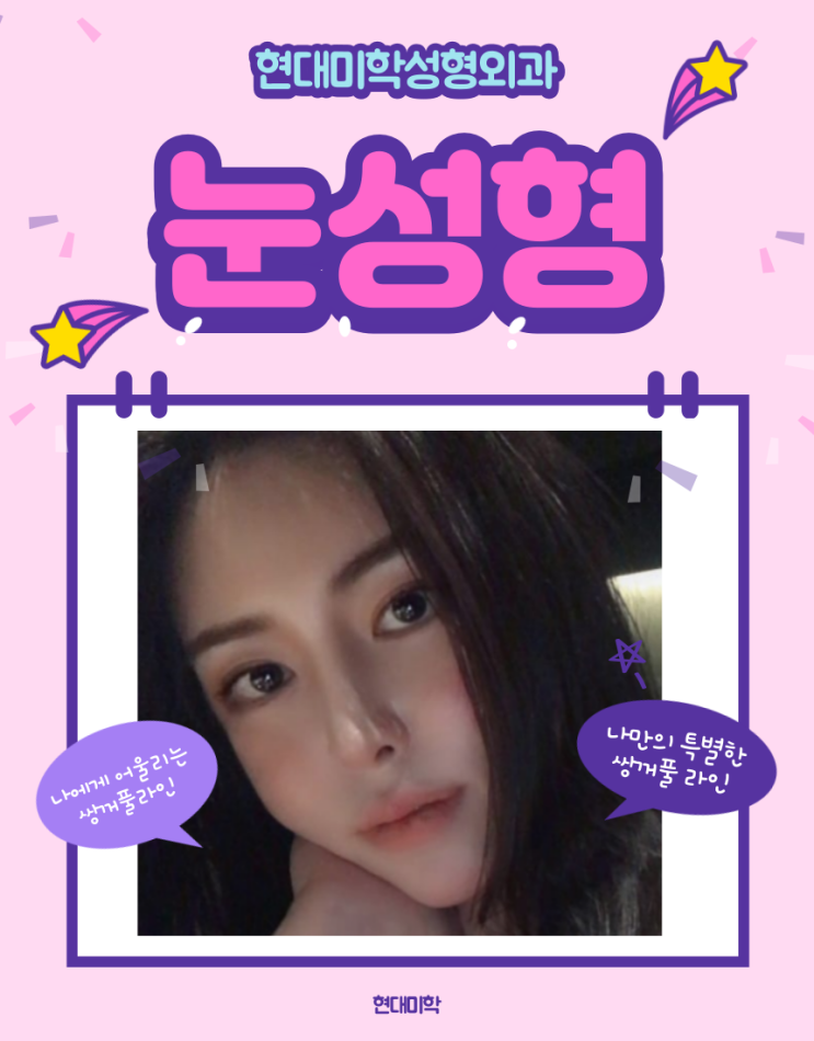강남역 눈성형비용 알고싶어요