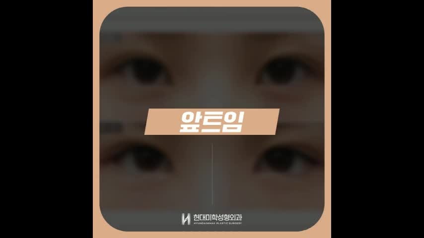 동영상