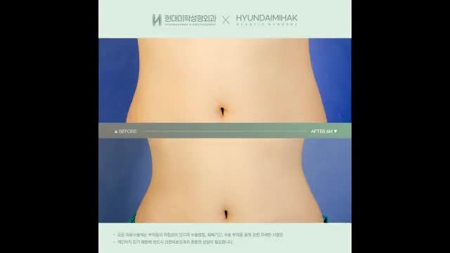 동영상