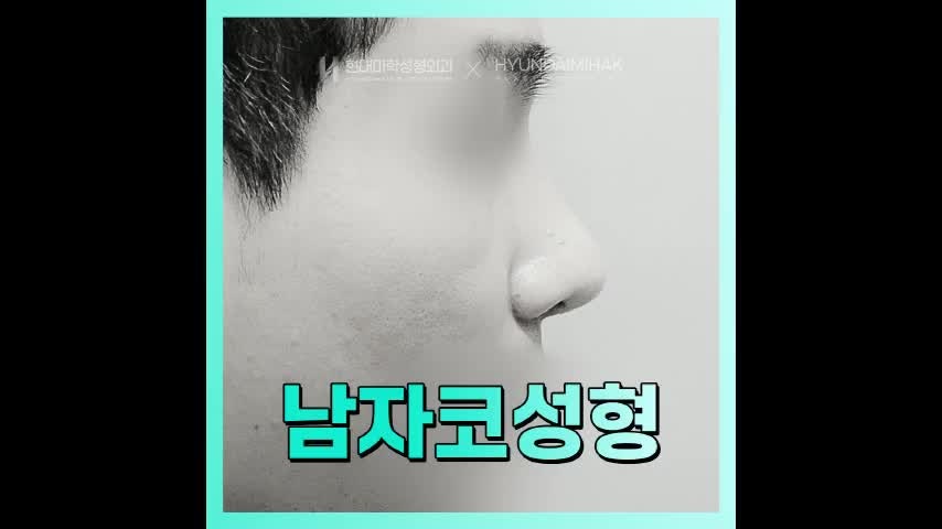 동영상