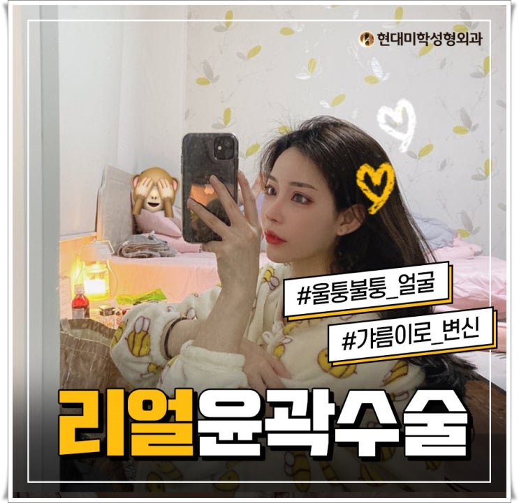 사각턱수술잘하는곳 놀라운 변화