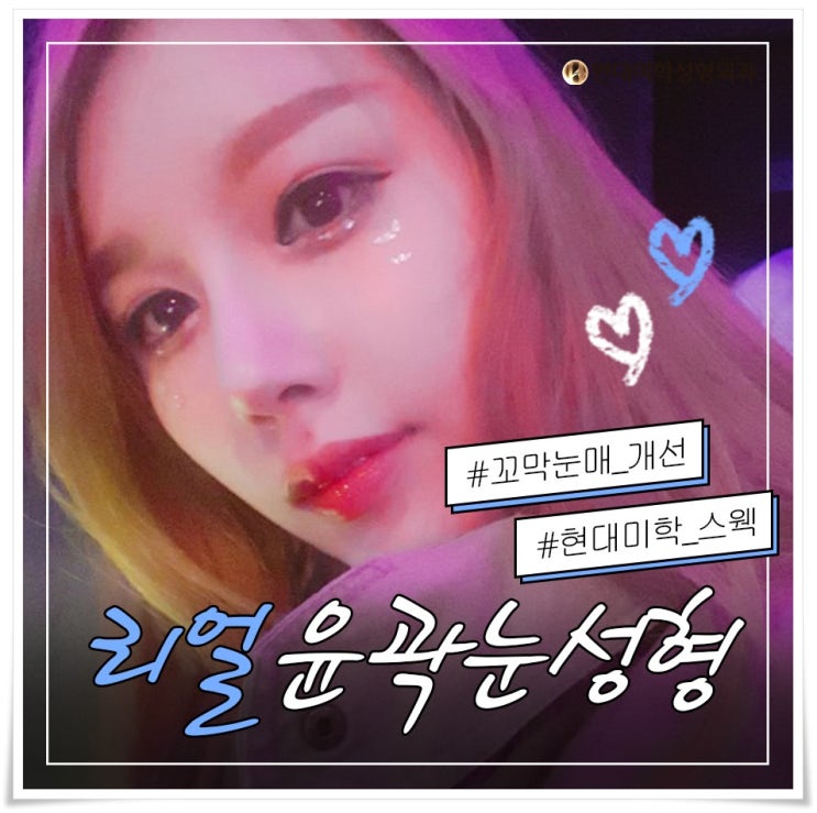 눈밑트임잘하는곳 놀랐지?