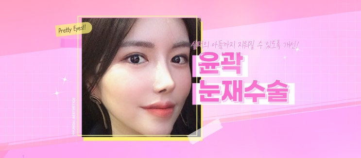 눈재수술잘하는곳 이렇게 알아봤어요.