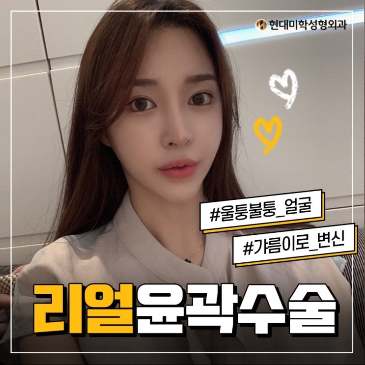 윤곽성형외과 갸름함을 찾았다