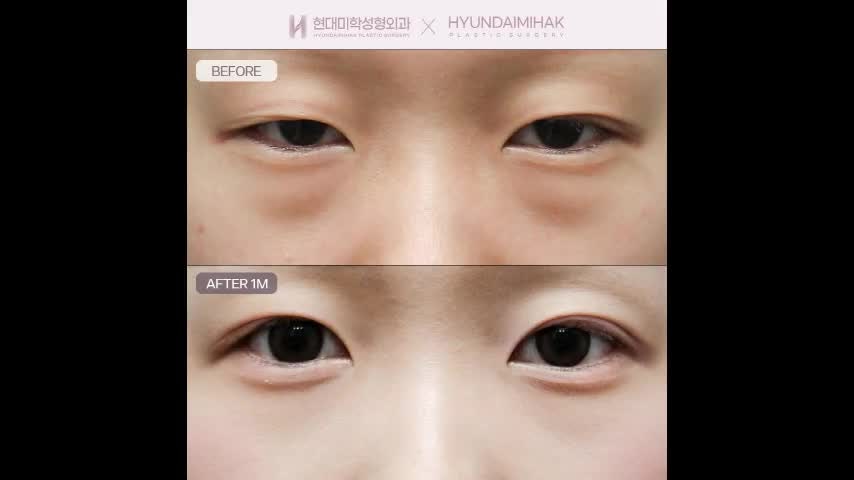동영상
